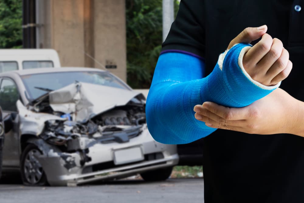 Hit and run injuries