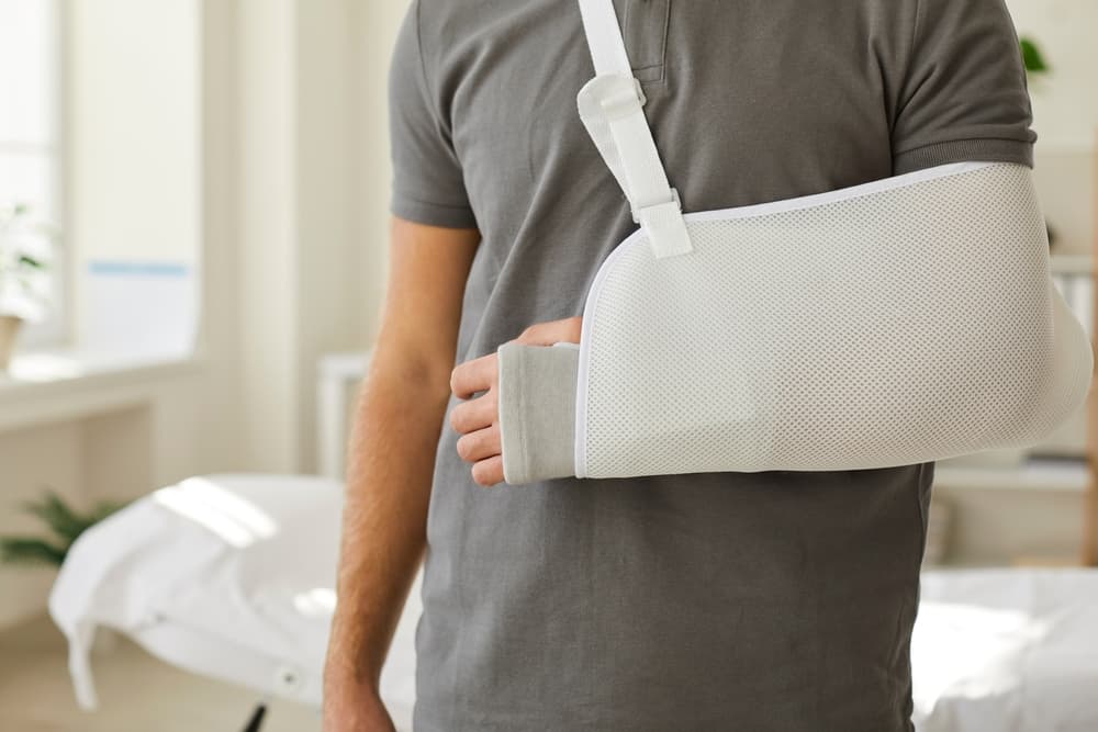 Closeup of man with broken arm