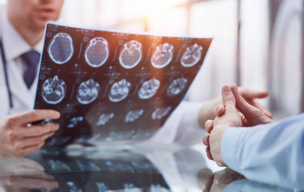 Doctor reviewing a patient’s brain scan results during a medical consultation for possible traumatic brain injury